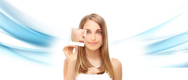 Skin Conditions
