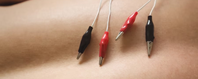 Power of Electroacupuncture