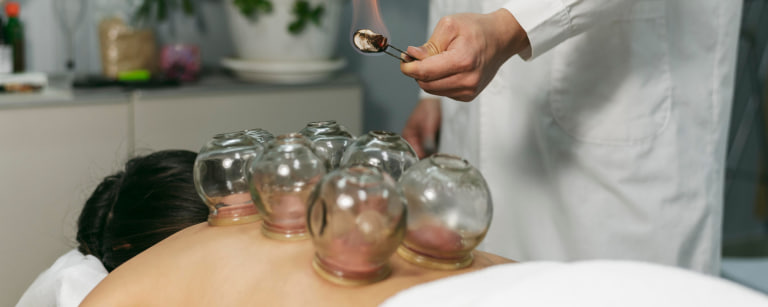 Cupping Treatment for Fatigue Relief