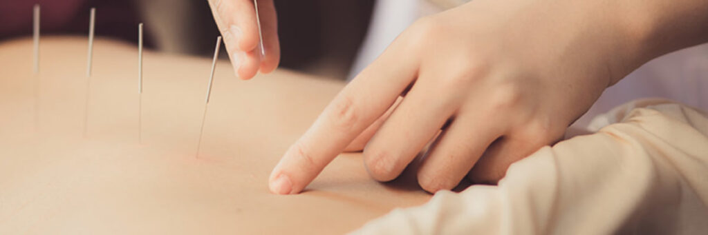 Acupuncture for Diabetes Management