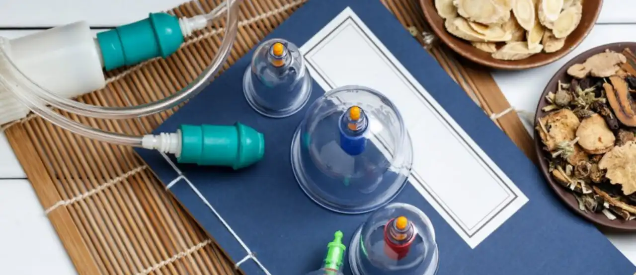 Cupping Therapy for Shoulder Pain