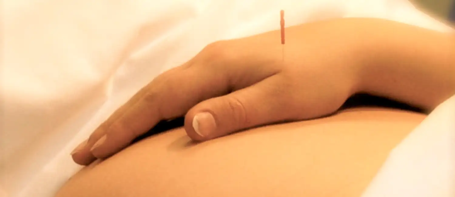 Acupuncture and the Art of Encouraging Natural Labor: A Holistic Approach