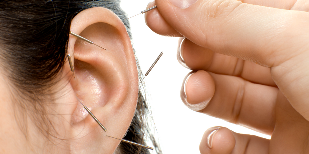 Acupuncture ear