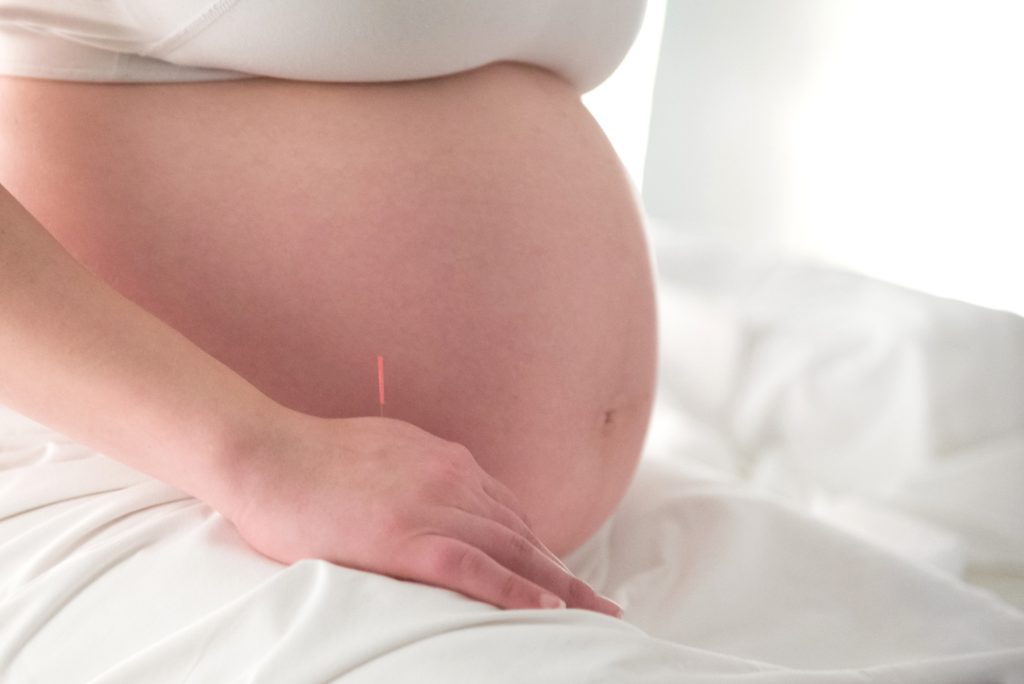 Pregnancy acupuncture treatment at The ON Acupuncture in Perth