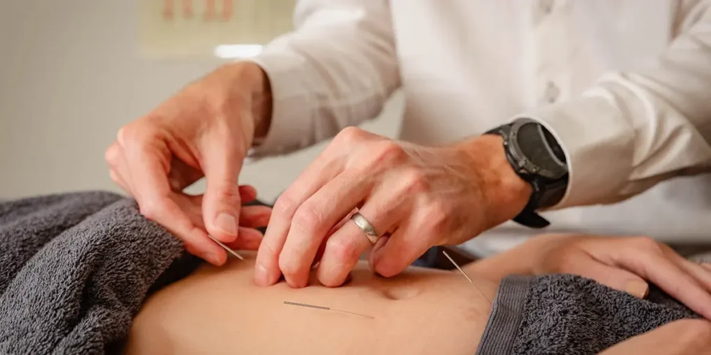 Acupuncture treatment for back pain in Perth at Willetton Chinese medicine clinic