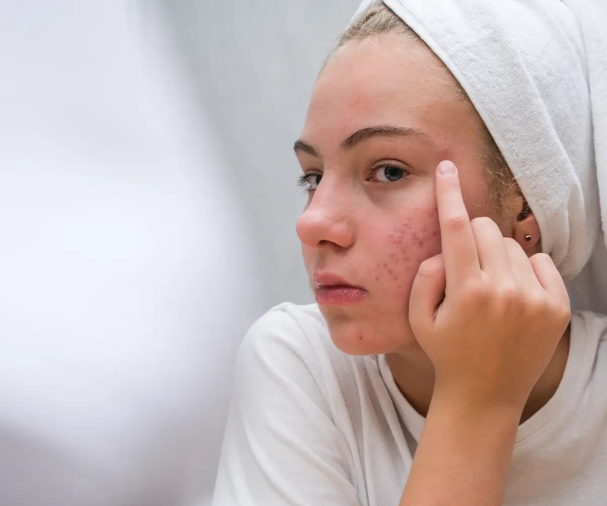 Skin Conditions 